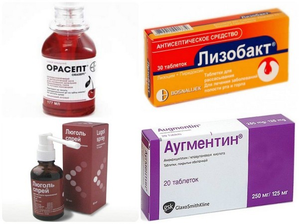 Чем лечить красное горло у ребенка – лучшие лекарства и средства 2019