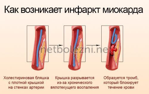 Болит и колит сердце при вдохе: причины, что делать?