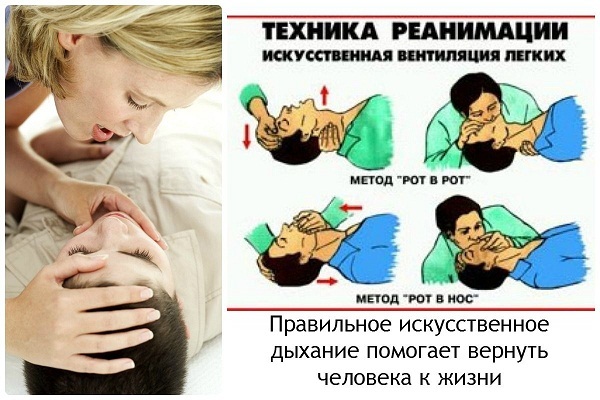 Искусственный массаж сердца и искусственное дыхание: техника проведения, правила и последовательность