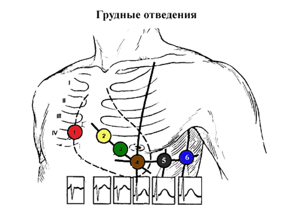Техника снятия электрокардиограммы