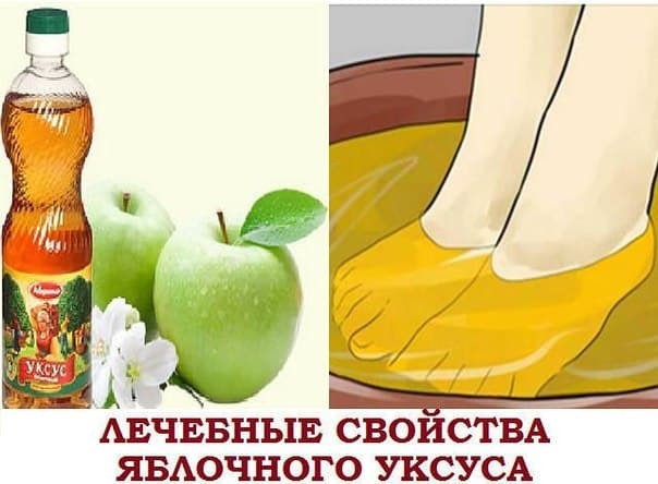 Яблочный уксус при варикозе: как и зачем принимать?