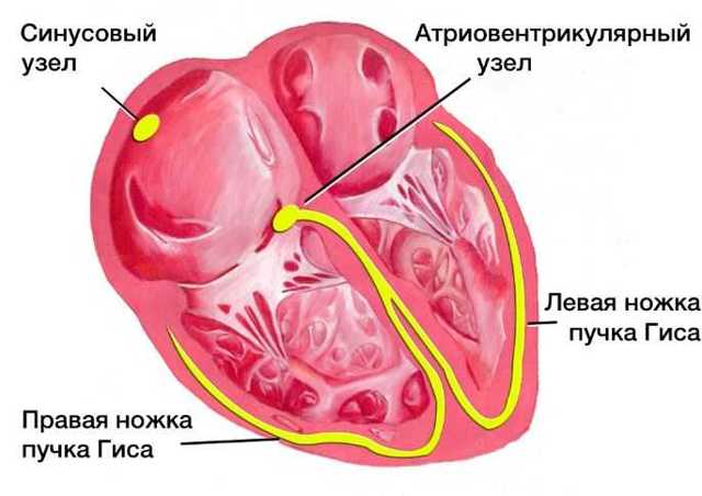 Блокада левой ножки пучка Гиса на ЭКГ (полная и неполная)