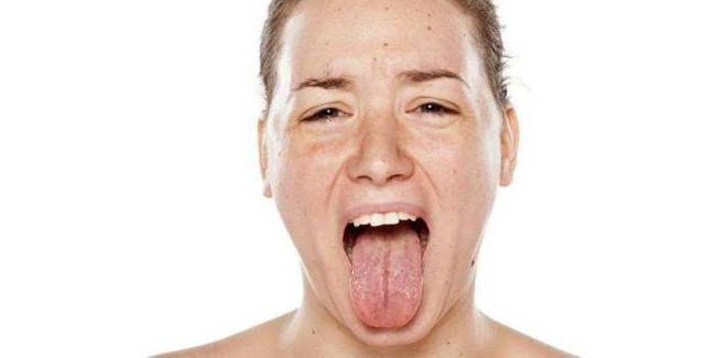 Коричневый налет на языке