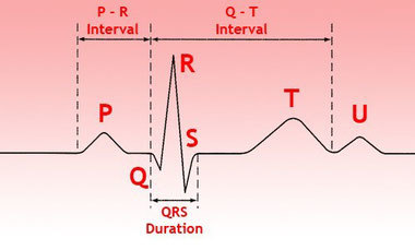 Стандартные отведения от конечностей - 1,2,3
