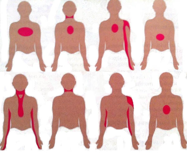 О Чем Говорит Боль в Грудной Клетке Посередине