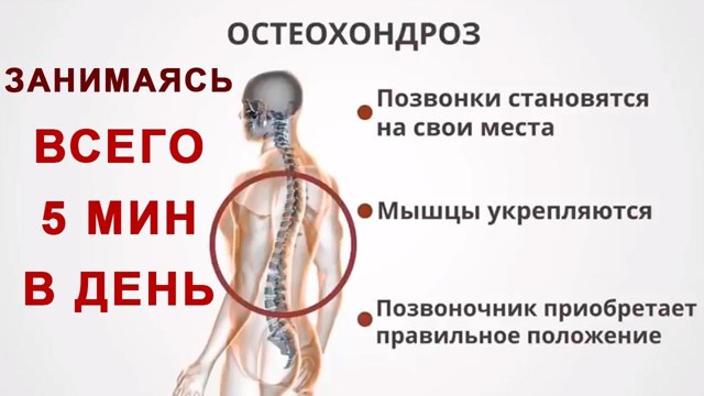 Симптомы боли в сердце при остеохондрозе грудного отдела