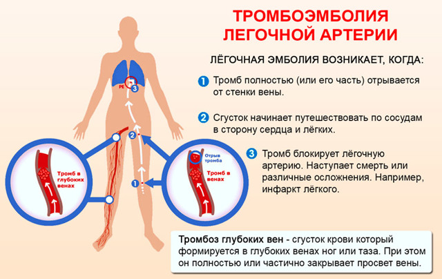 Болит сердце и тяжело дышать
