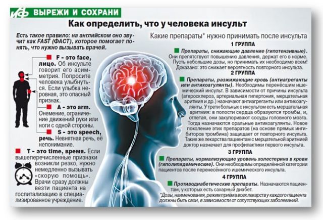 Предпосылки инсульта головного мозга у женщин - как избежать инсульта у женщин