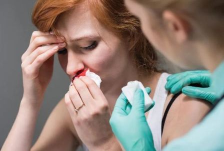 Первая помощь при кровотечении из носа: как правильно оказать медицинскую помощь (алгоритм) при сильном кровотечении, что нужно делать чтобы из носа пошла кровь без боли