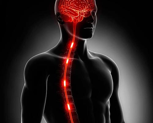 Инсульт спинного мозга (спинальный): симптомы, лечение, последствия