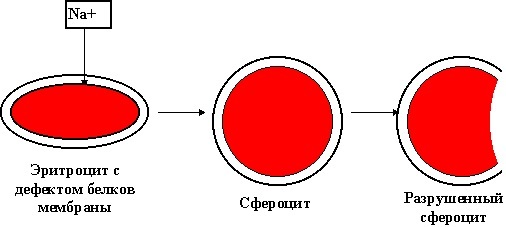 Болезнь Минковского-Шоффара: симптомы, причины возникновения, лечение
