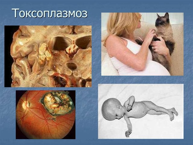 Токсоплазмоз у взрослых: как передается, симптомы и лечение