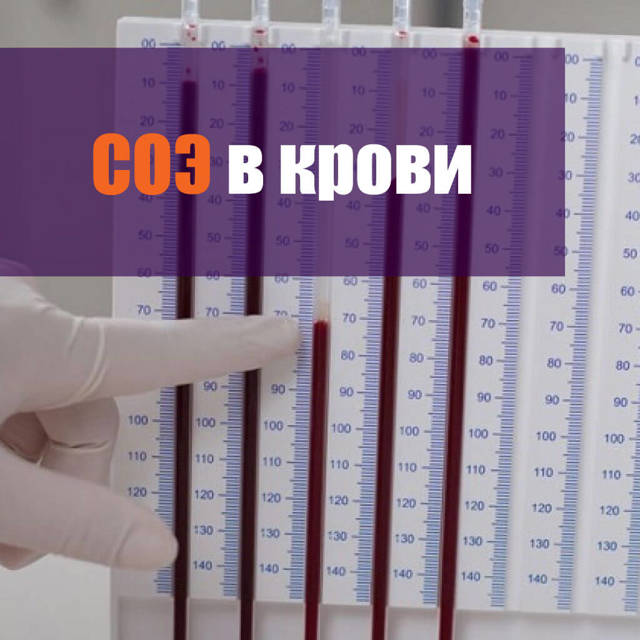СОЭ норма для женщин после 50 - 55 лет