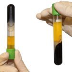 Анализ PH крови — как определить уровень КЩБ, причины повышения и понижения