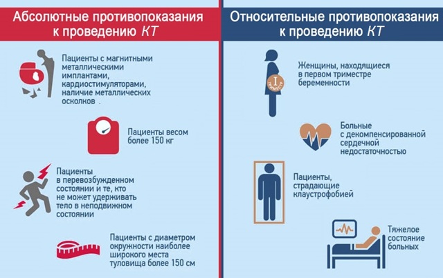 Ангиография сосудов головного мозга - подготовка и ход процедуры
