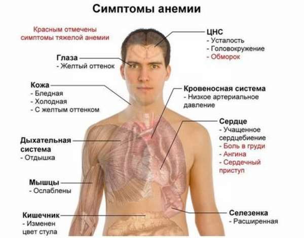 Низкий гемоглобин - почему понижается, лекарственные препараты и продукты питания для повышения