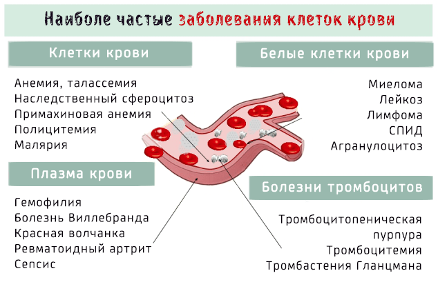 Болезнь крови. Болезни органов крови