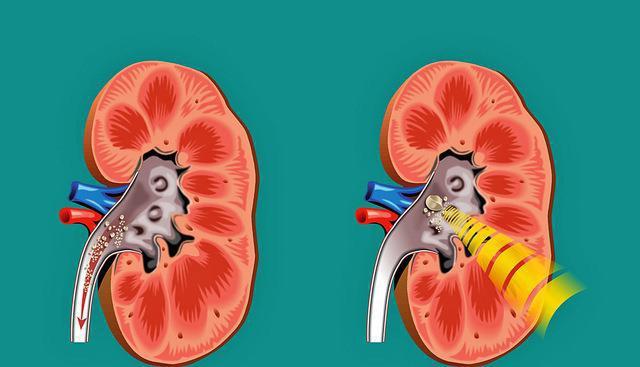 Аллопуринол - официальная инструкция по применению, аналоги