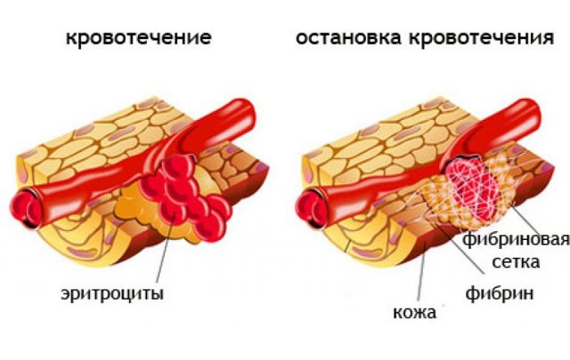 Фибриноген выше нормы – что это значит, что это такое, что делать? Фибриноген в крови – норма у женщин