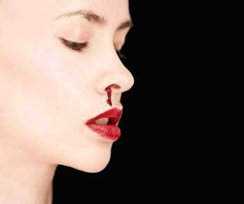 Почему идёт кровь из носа у взрослого человека. Причины и лечение народными средствами