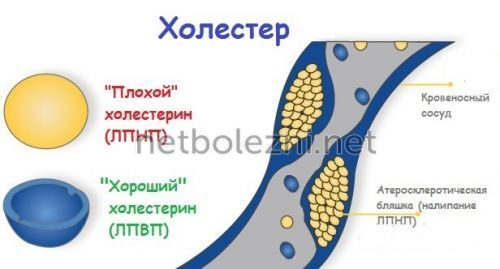 Как снизить высокий холестерин причины и лечение