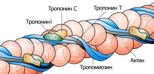 Анализы при стенокардии - общий анализ крови, холестерин, тропонины