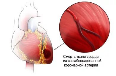 АСТ в крови – какова норма, причины повышения, что означает анализ крови АСТ?