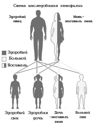 Почему гемофилия - царская болезнь