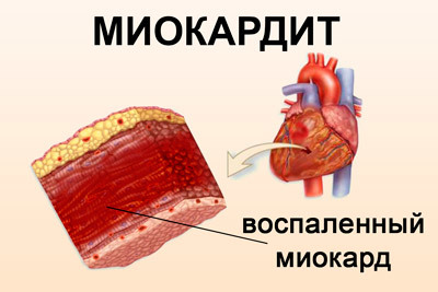 Какое должно быть сердцебиение у человека