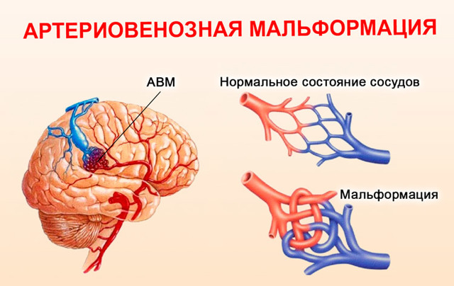 Почему в ушах стучит пульс