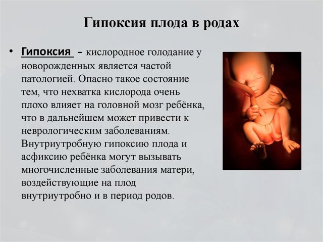 КТГ при беременности: расшифровка и норма, сроки и что показывает по неделям - видео