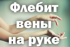 Флебит вены на руке. Лечение постинъекционного флебита после катетера