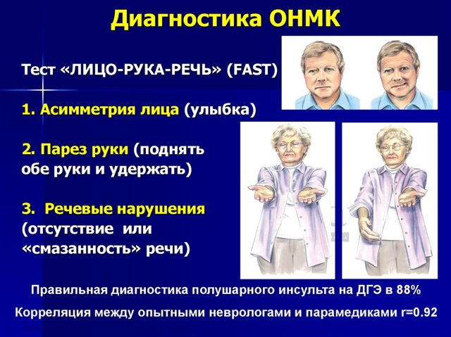 Что такое Острое нарушение мозгового кровообращения?