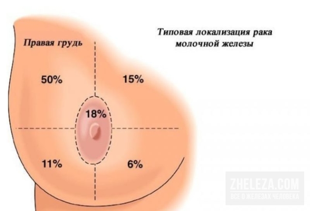 Боль в правой груди: что это может означать