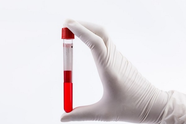 Диета по группе крови 1 положительная: таблица продуктов