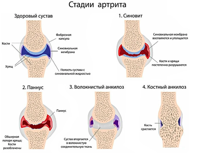 Болит вена на пальце: что это - ответы и советы на твои вопросы