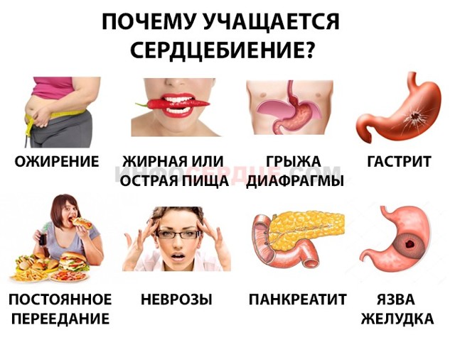 После еды учащается сердцебиение причины — Сердце