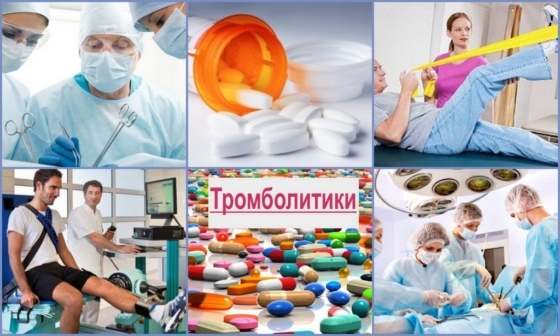 Тромбоз артерий нижних конечностей симптомы лечение