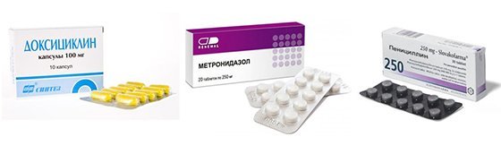 Острый, язвенно-некротический гингивит Венсана: лечение, симптомы и диагностика