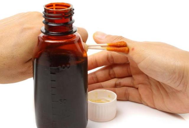 Лечение гипертонии йодом (по индийскому методу)