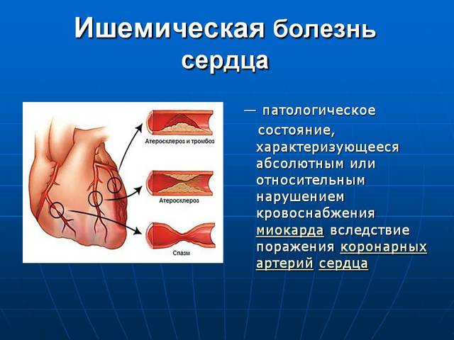 Боль в грудине слева: причины. Почему болит в левой части грудной клетки