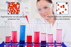 Признаки заболеваний крови