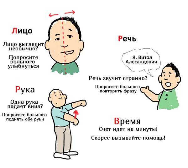 Ишемический инсульт: симптомы и лечение