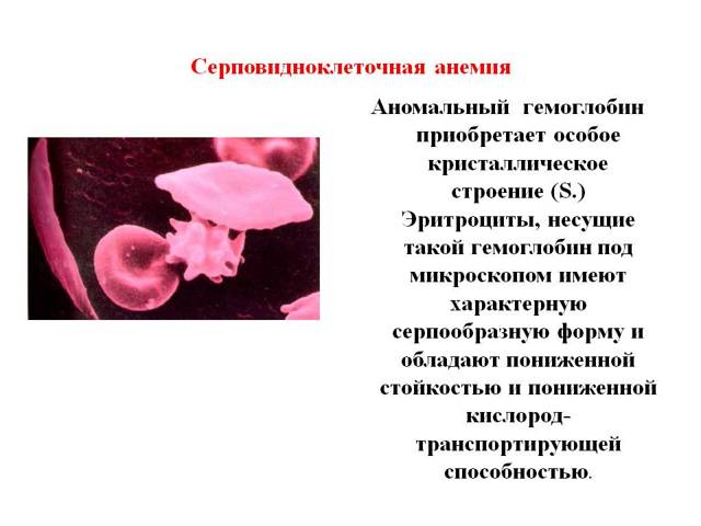 Серповидноклеточная анемия и типы ее наследования.