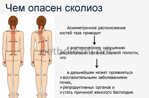О чем говорит боль в грудной клетке посередине при вдохе? О чем говорят боли в грудной клетке при вдохе