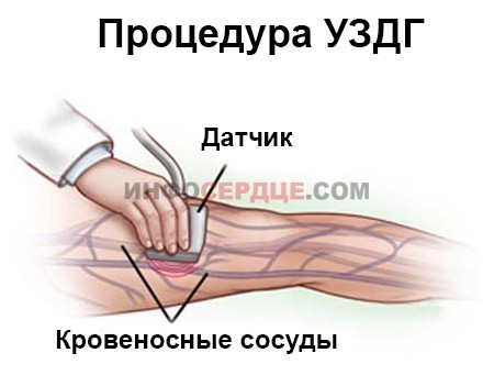 УЗДГ вен нижних конечностей (технологии 2019)
