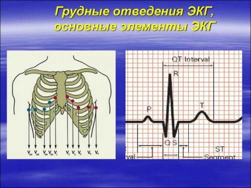 Левые и правые отведения на экг - Все про гипертонию