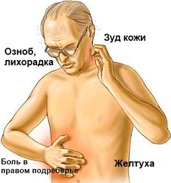 Какова норма билирубина в крови у взрослого человека? Основные показатели.