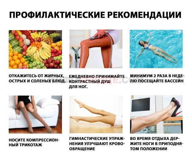Кдо что это такое | Все о ретикулярном варикозе