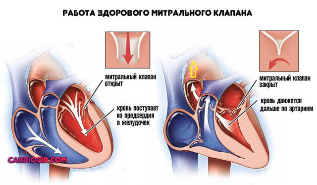 Регургитация 1 степени что это такое - Всё о сердце